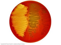 Blood agar with Alpha, Beta and Gamma Hemolytic patterns